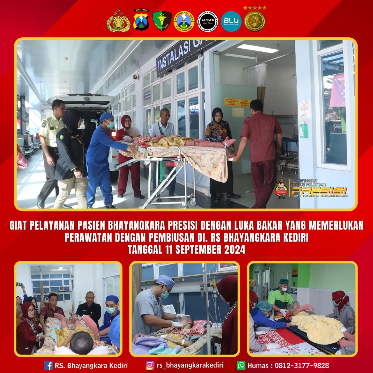 Giat pelayanan pasien Bhayangkara Presisi dengan luka bakar yang memerlukan perawatan dengan pembiusan di RS Bhayangkara Kediri, 11 September 2024