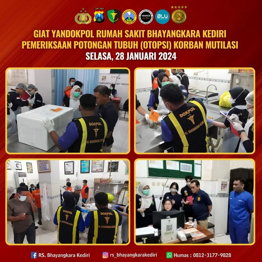 PELAYANAN KEDOKTERAN KEPOLISIAN PEMERIKSAAN POTONGAN TUBUH OTOPSI KORBAN MUTILASI DI HOTEL KEDIRI